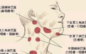 颈部淋巴结炎症状
