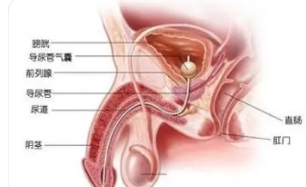 慢性前列腺炎症状
