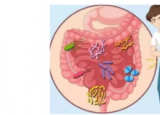 肠炎的症状及治疗