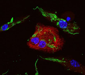 研究表明利什曼原虫操纵生物体的防御系统继续复制