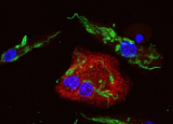 研究表明利什曼原虫操纵生物体的防御系统继续复制