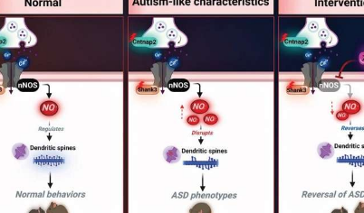 在小鼠模型中发现一氧化氮水平在自闭症谱系障碍中具有可逆的致病作用
