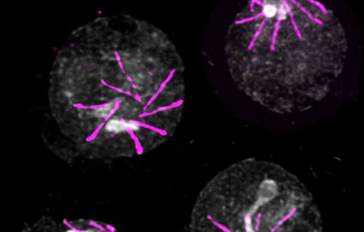 科学家认为使疟疾寄生虫迷失方向可以防止它造成伤害