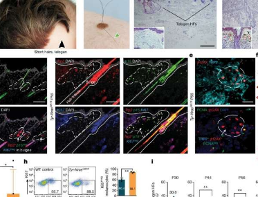 研究人员揭示刺激毛发生长的新分子机制