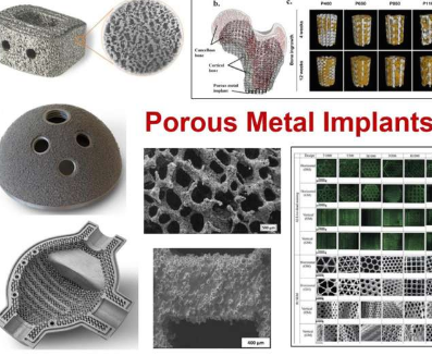 研究骨科植入物及其他领域的多孔金属