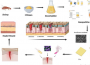 用于伤口敷料的可持续壳聚糖纳米复合材料的进展
