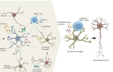 新的基于人体细胞的3D模型揭示了免疫细胞如何导致阿尔茨海默氏病的见解