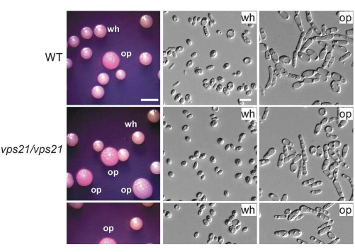 Vps21信号通路调控白色念珠菌白色不透明转换和交配