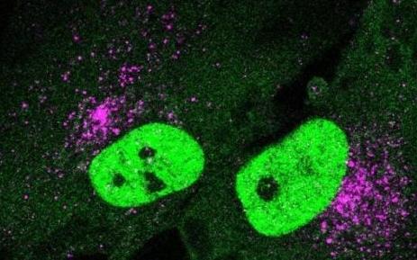 匹兹堡大学研究发现STING蛋白在细胞健康和衰老中发挥双重作用