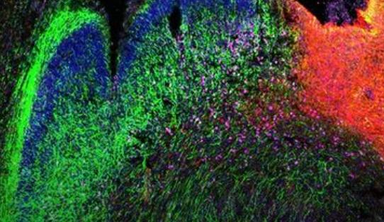 3D多组学为人类大脑发育研究增添深度